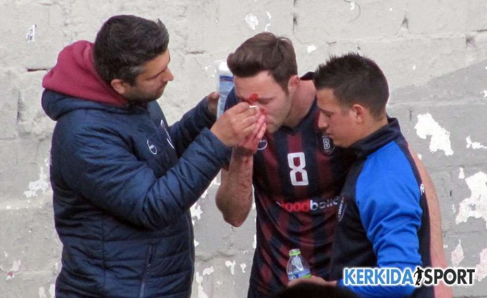 Ο μεγάλος απών από τους πανηγυρισμούς (φωτο)